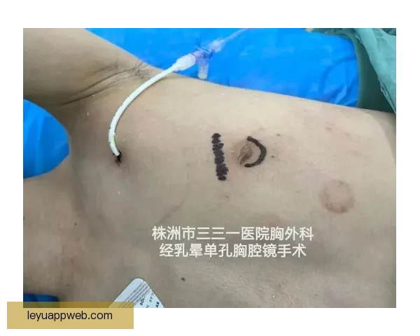 坎宁安气胸康复持续推进 活塞计划一周后复查评估